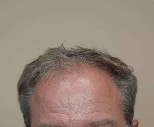 Advanced Hair Renewal Cntr