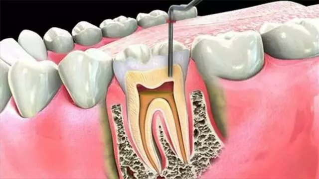Advanced Dentistry of Blue Ash - David J Schlueter, DDS