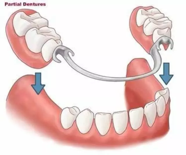 Advanced Dentistry of Blue Ash - David J Schlueter, DDS
