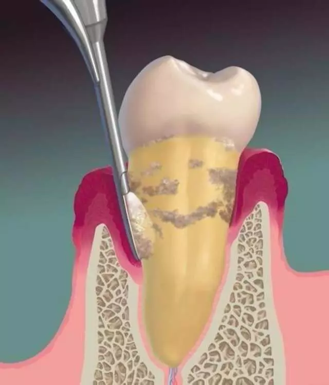 Advanced Dentistry of Blue Ash - David J Schlueter, DDS