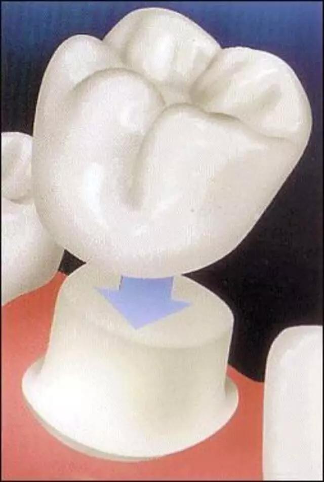 Advanced Dentistry of Blue Ash - David J Schlueter, DDS