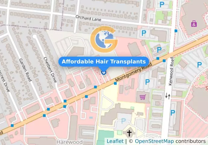 Affordable Hair Transplants