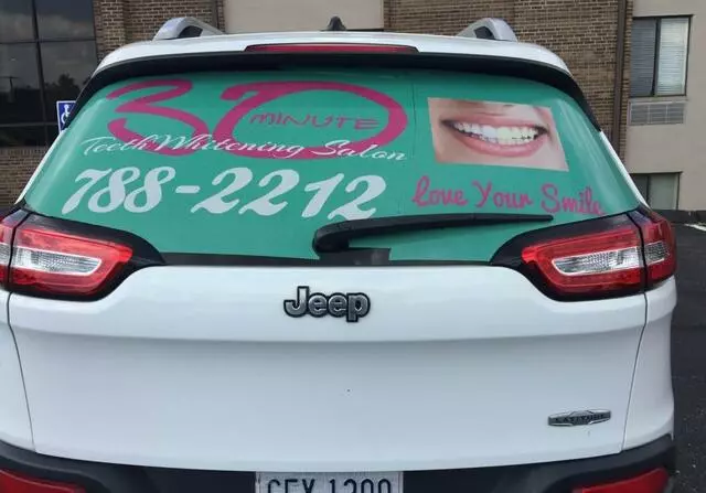 30 Minute Teeth Whitening