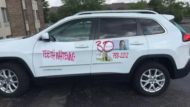 30 Minute Teeth Whitening